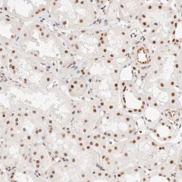 Anti-ZBED6 antibody produced in rabbit, 1 X 100 µL (HPA026439-100UL)