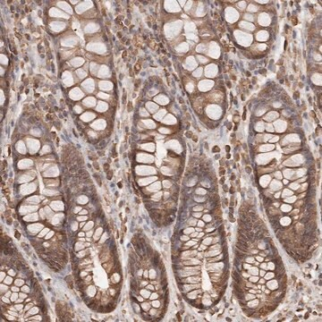 Anti-ARHGEF10L antibody produced in rabbit, 1 X 100 µL (HPA026426-100UL)