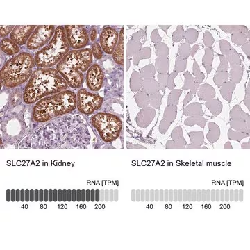 Anti-SLC27A2 antibody produced in rabbit, 1 X 100 µL (HPA026089-100UL)