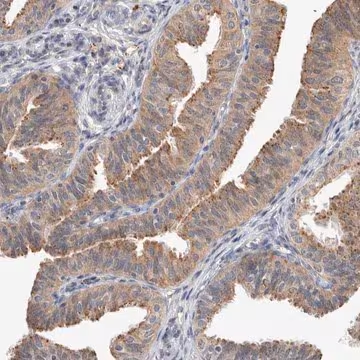 Anti-MRPL37 antibody produced in rabbit, 1 X 100 µL (HPA025951-100UL)