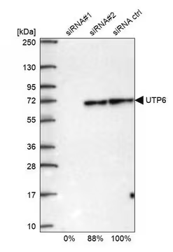 Anti-UTP6 antibody produced in rabbit, 1 X 100 µL (HPA025936-100UL)