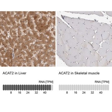 Anti-ACAT2 antibody produced in rabbit, 1 X 100 µL (HPA025811-100UL)