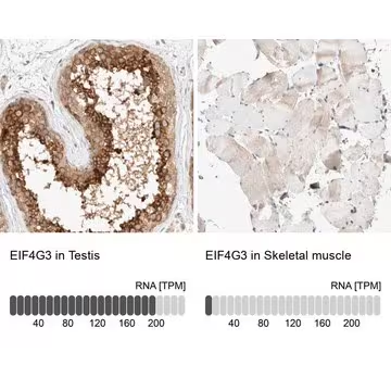 Anti-EIF4G3 antibody produced in rabbit, 1 X 100 µL (HPA025039-100UL)
