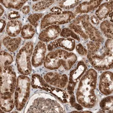 Anti-WDYHV1 antibody produced in rabbit, 1 X 100 µL (HPA024823-100UL)