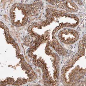 Anti-CRISPLD1 antibody produced in rabbit, 1 X 100 µL (HPA024725-100UL)