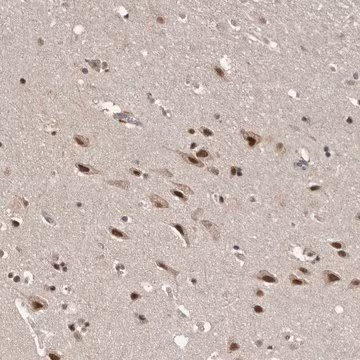 Anti-VPS37A antibody produced in rabbit, 1 X 100 µL (HPA024705-100UL)