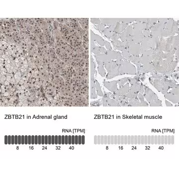 Anti-ZBTB21 antibody produced in rabbit, 1 X 100 µL (HPA024655-100UL)