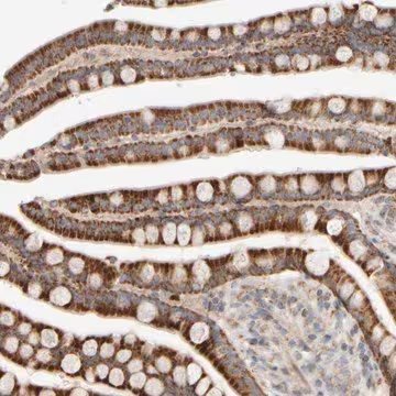 Anti-CHADL antibody produced in rabbit, 1 X 100 µL (HPA024654-100UL)