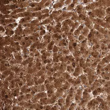 Anti-PGM1 antibody produced in rabbit, 1 X 100 µL (HPA024637-100UL)