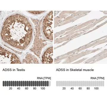 Anti-ADSS antibody produced in rabbit, 1 X 100 µL (HPA024400-100UL)