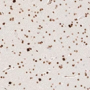 Anti-ZSCAN18 antibody produced in rabbit, 1 X 100 µL (HPA024318-100UL)
