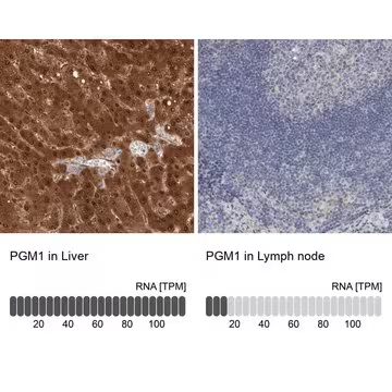 Anti-PGM1 antibody produced in rabbit, 1 X 100 µL (HPA024190-100UL)