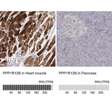Anti-PPP1R12B antibody produced in rabbit, 1 X 100 µL (HPA024171-100UL)