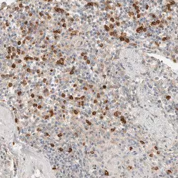 Anti-CCDC171 antibody produced in rabbit, 1 X 100 µL (HPA024133-100UL)