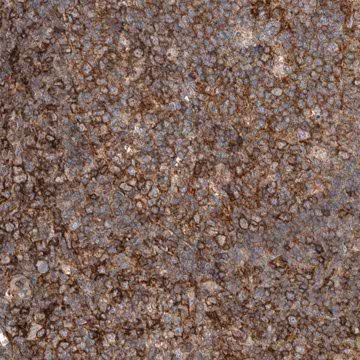 Anti-UGCG antibody produced in rabbit, 1 X 100 µL (HPA024124-100UL)