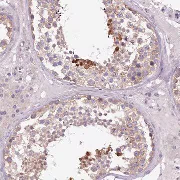 Anti-SETX antibody produced in rabbit, 1 X 100 µL (HPA024105-100UL)