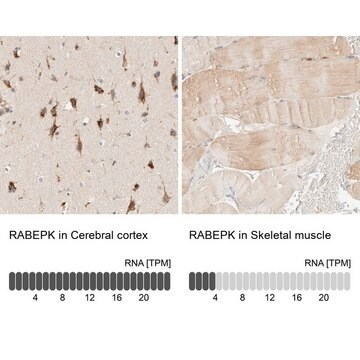 Anti-RABEPK antibody produced in rabbit, 1 X 100 µL (HPA023920-100UL)