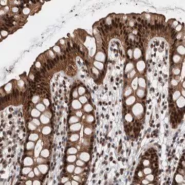 Anti-FAM135B antibody produced in rabbit, 1 X 100 µL (HPA023911-100UL)