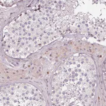 Anti-ZNF583 antibody produced in rabbit, 1 X 100 µL (HPA023805-100UL)