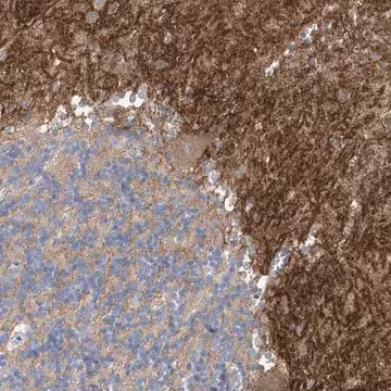 Anti-TTYH1 antibody produced in rabbit, 1 X 100 µL (HPA023617-100UL)