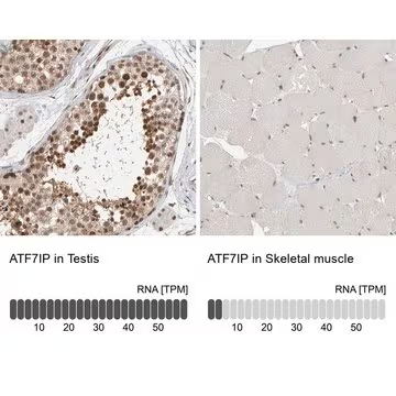 Anti-ATF7IP antibody produced in rabbit, 1 X 100 µL (HPA023505-100UL)