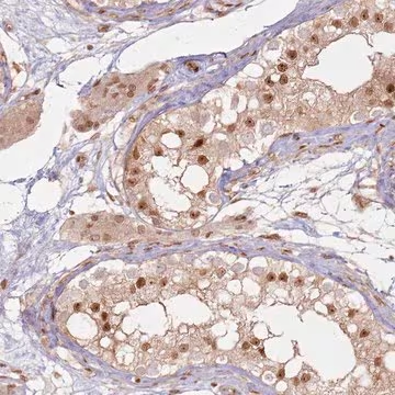 Anti-KLHL36 antibody produced in rabbit, 1 X 100 µL (HPA023423-100UL)
