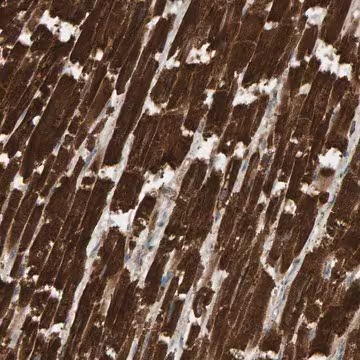Anti-DUS1L antibody produced in rabbit, 1 X 100 µL (HPA023384-100UL)