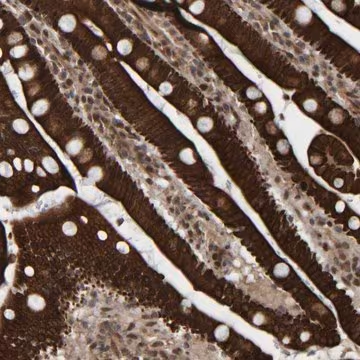 Anti-CCDC57 antibody produced in rabbit, 1 X 100 µL (HPA023342-100UL)