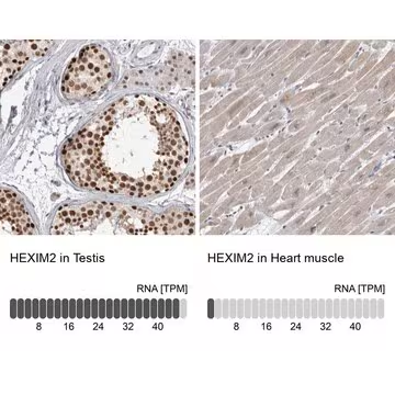 Anti-HEXIM2 antibody produced in rabbit, 1 X 100 µL (HPA023323-100UL)