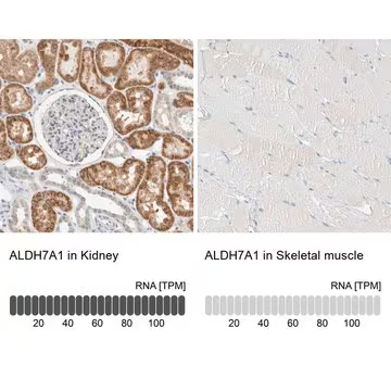 Anti-ALDH7A1 antibody produced in rabbit, 1 X 100 µL (HPA023296-100UL)