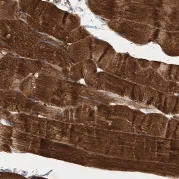 Anti-ELP5 antibody produced in rabbit, 1 X 100 µL (HPA023279-100UL)