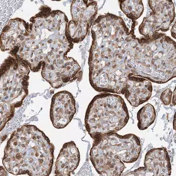 Anti-WWP1 antibody produced in rabbit, 1 X 100 µL (HPA023180-100UL)