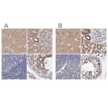 Anti-EFR3A antibody produced in rabbit, 1 X 100 µL (HPA023092-100UL)