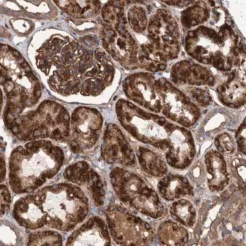 Anti-SLC25A10 antibody produced in rabbit, 1 X 100 µL (HPA023048-100UL)