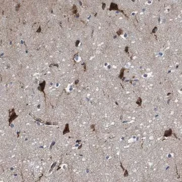 Anti-RAP1GAP2 antibody produced in rabbit, 1 X 100 µL (HPA022896-100UL)