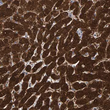 Anti-MRPS7 antibody produced in rabbit, 1 X 100 µL (HPA022522-100UL)