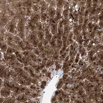 Anti-MBTD1 antibody produced in rabbit, 1 X 100 µL (HPA021876-100UL)