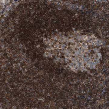 Anti-TPK1 antibody produced in rabbit, 1 X 100 µL (HPA021849-100UL)