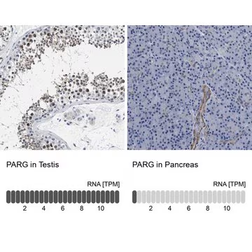 Anti-PARG antibody produced in rabbit, 1 X 100 µL (HPA021819-100UL)