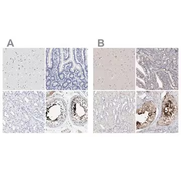 Anti-ACTL7B antibody produced in rabbit, 1 X 100 µL (HPA021803-100UL)