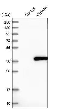 Anti-CENPP antibody produced in rabbit, 1 X 100 µL (HPA021787-100UL)