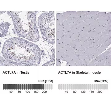 Anti-ACTL7A antibody produced in rabbit, 1 X 100 µL (HPA021624-100UL)