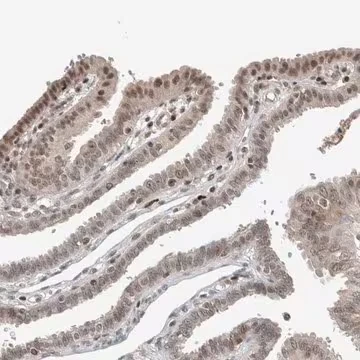 Anti-ZNF592 antibody produced in rabbit, 1 X 100 µL (HPA021600-100UL)