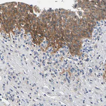 Anti-NT5C antibody produced in rabbit, 1 X 100 µL (HPA021581-100UL)