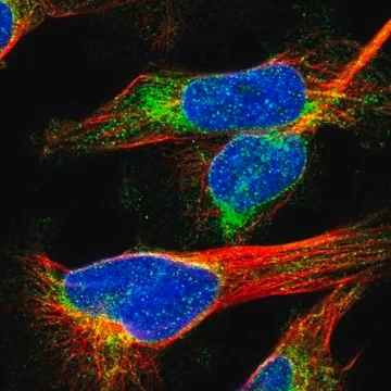 Anti-MCM3AP antibody produced in rabbit, 1 X 100 µL (HPA021527-100UL)