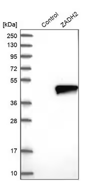 Anti-ZADH2 antibody produced in rabbit, 1 X 100 µL (HPA021468-100UL)