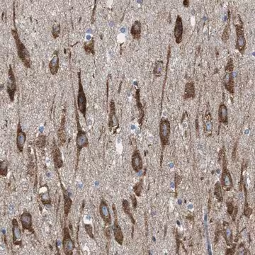 Anti-WDR60 antibody produced in rabbit, 1 X 100 µL (HPA021316-100UL)