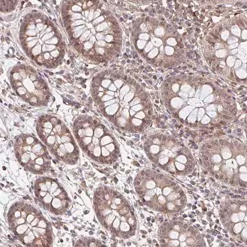 Anti-NUB1 antibody produced in rabbit, 1 X 100 µL (HPA021220-100UL)