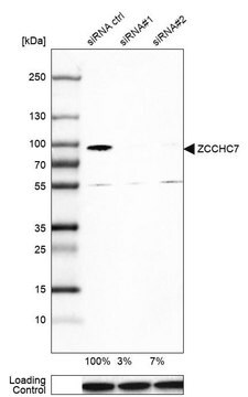 Anti-ZCCHC7 antibody produced in rabbit, 1 X 100 µL (HPA021088-100UL)