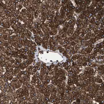 Anti-TPP2 antibody produced in rabbit, 1 X 100 µL (HPA021069-100UL)